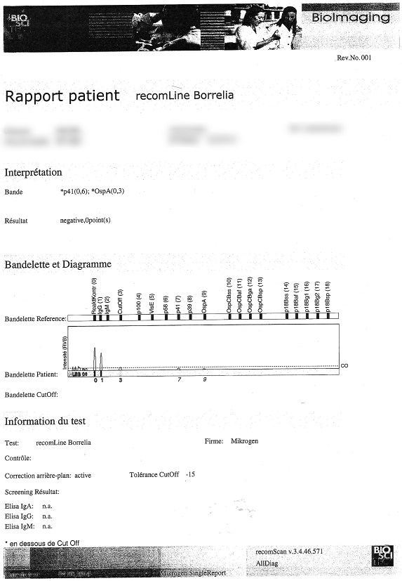 borrelia11.jpg